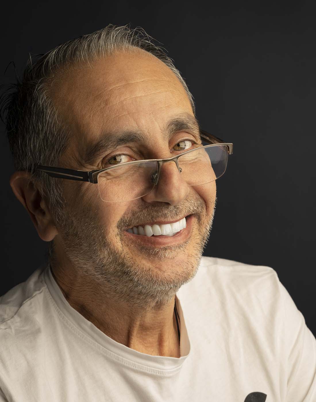 Revolutionizing All on Four Implant Restorations with Cutting-Edge Imetric4D Technology