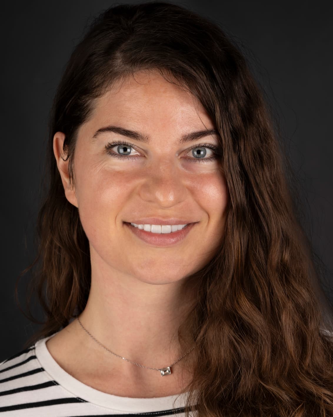 SMILE DESIGN WITH EMAX DENTAL VENEERS