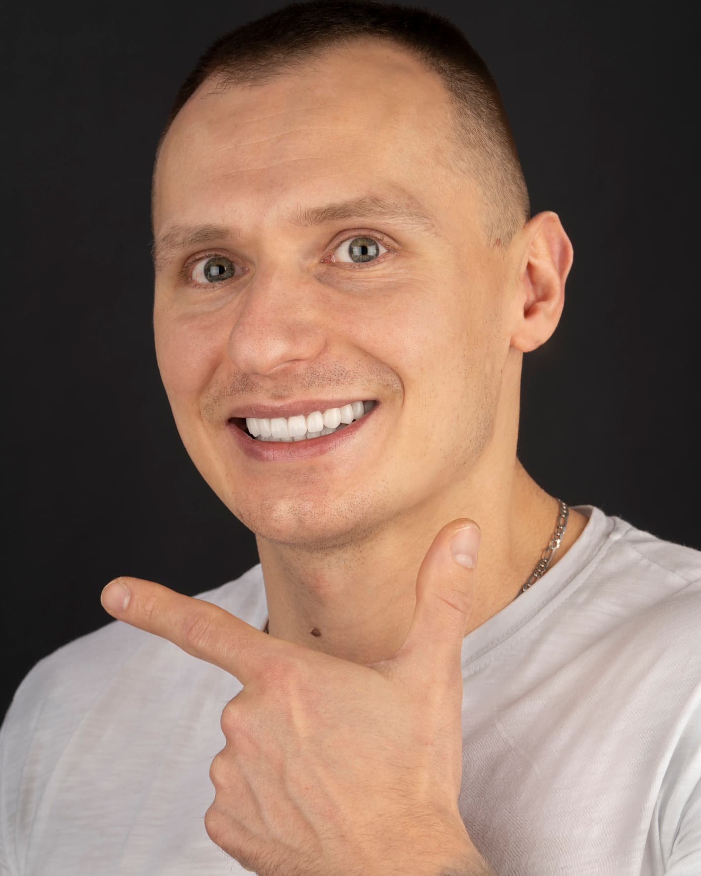 SMILE DESIGNS WITH ZIRCONIA CROWNS