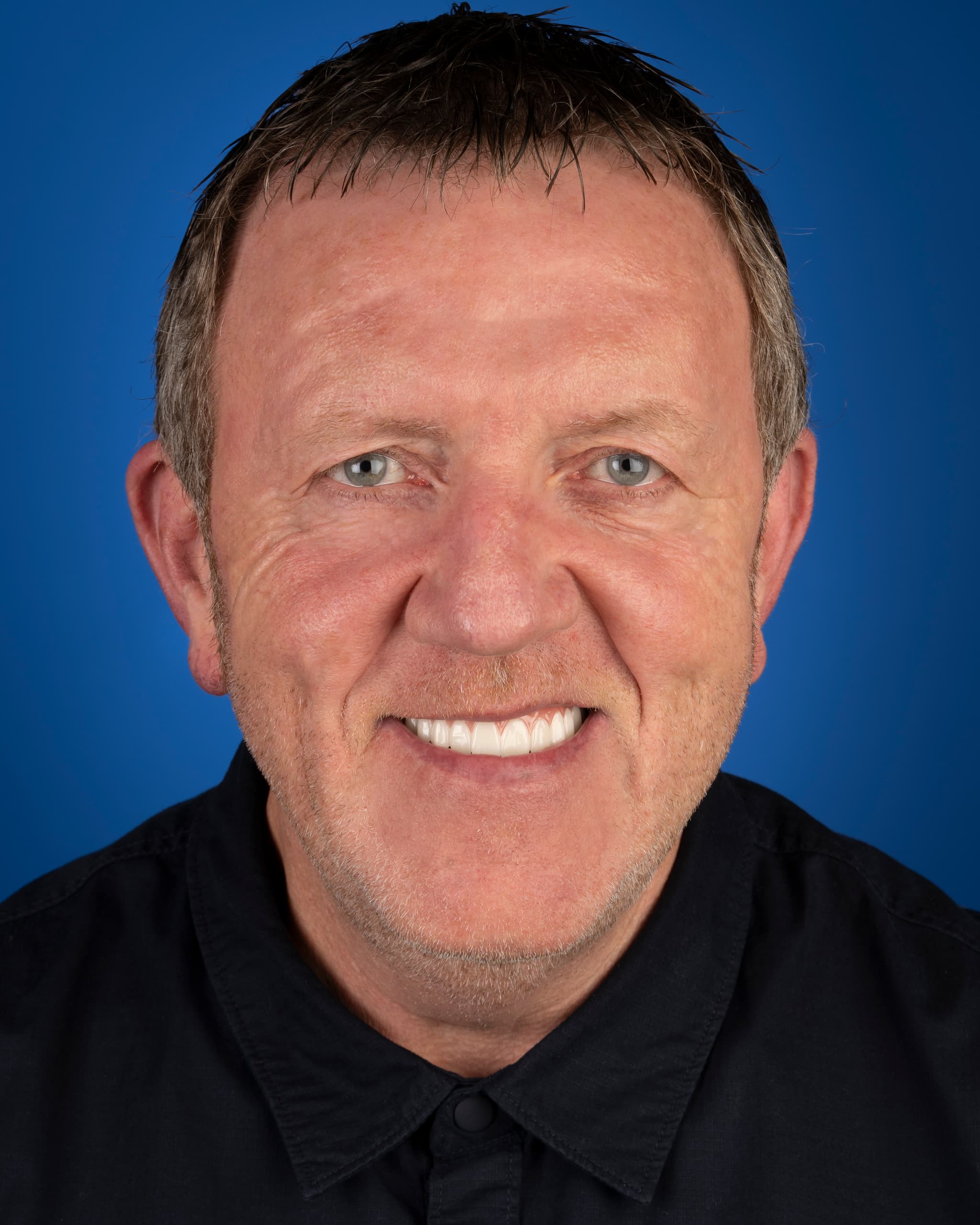 UK - Smile Design, 24x Zirconia Crowns