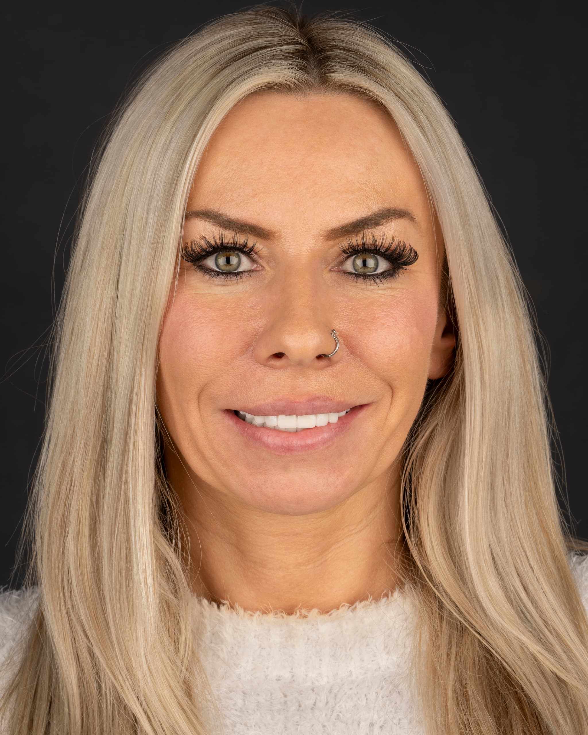 Poland - Smile Design, 7x E.max Crowns