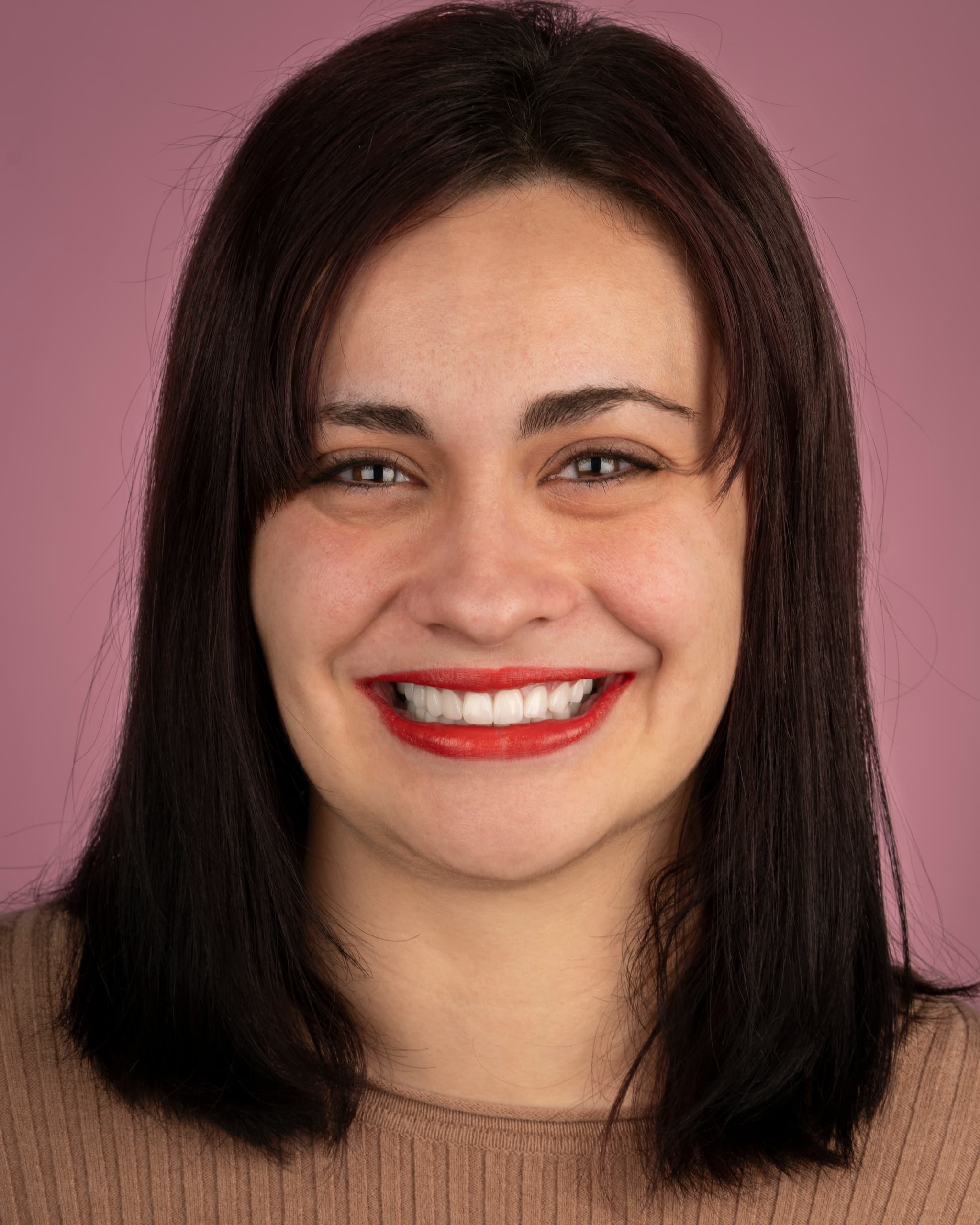 Malta - Smile Design, 28x Zirconia Crowns