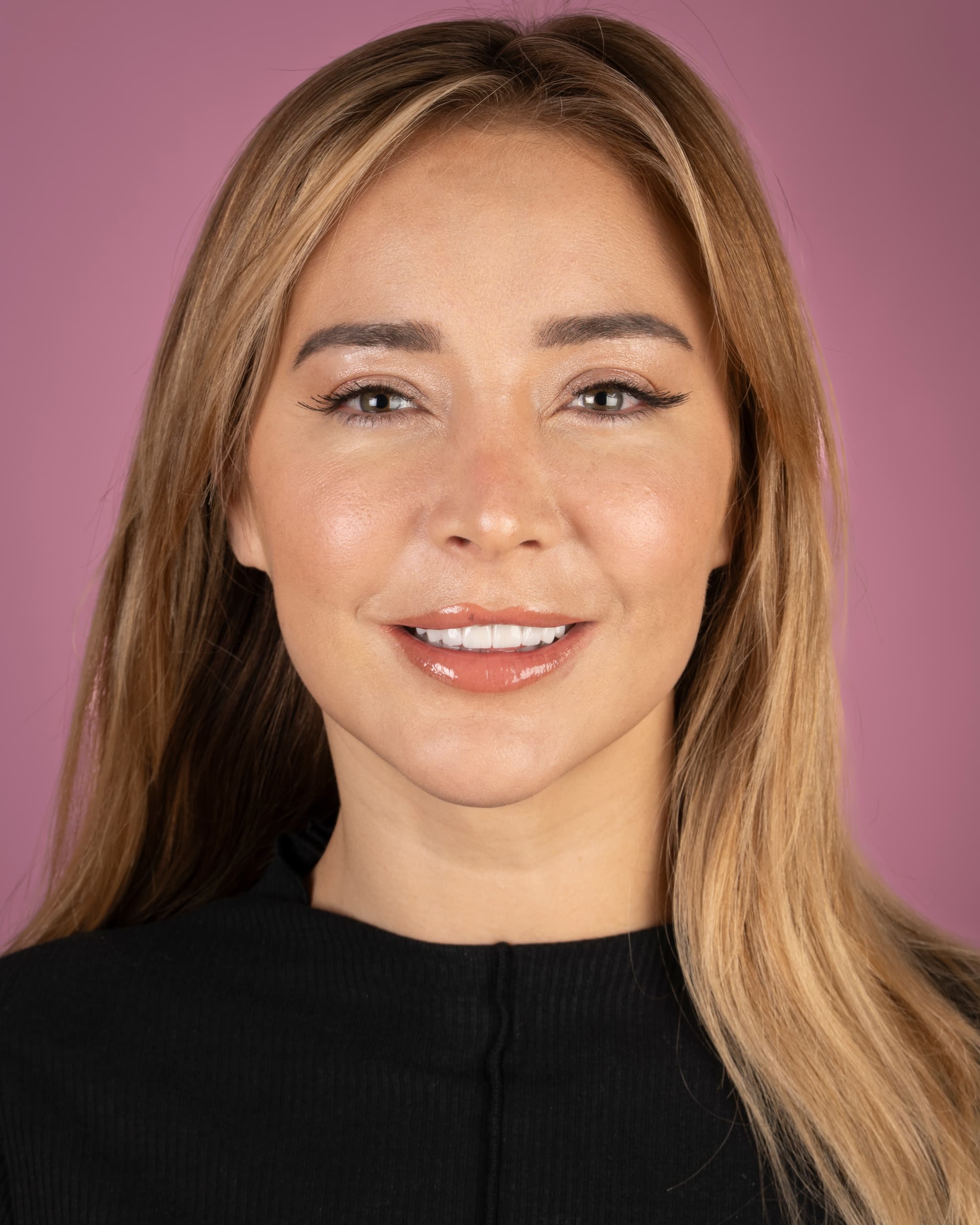 UK - Smile Design, 20x E.max Veneers