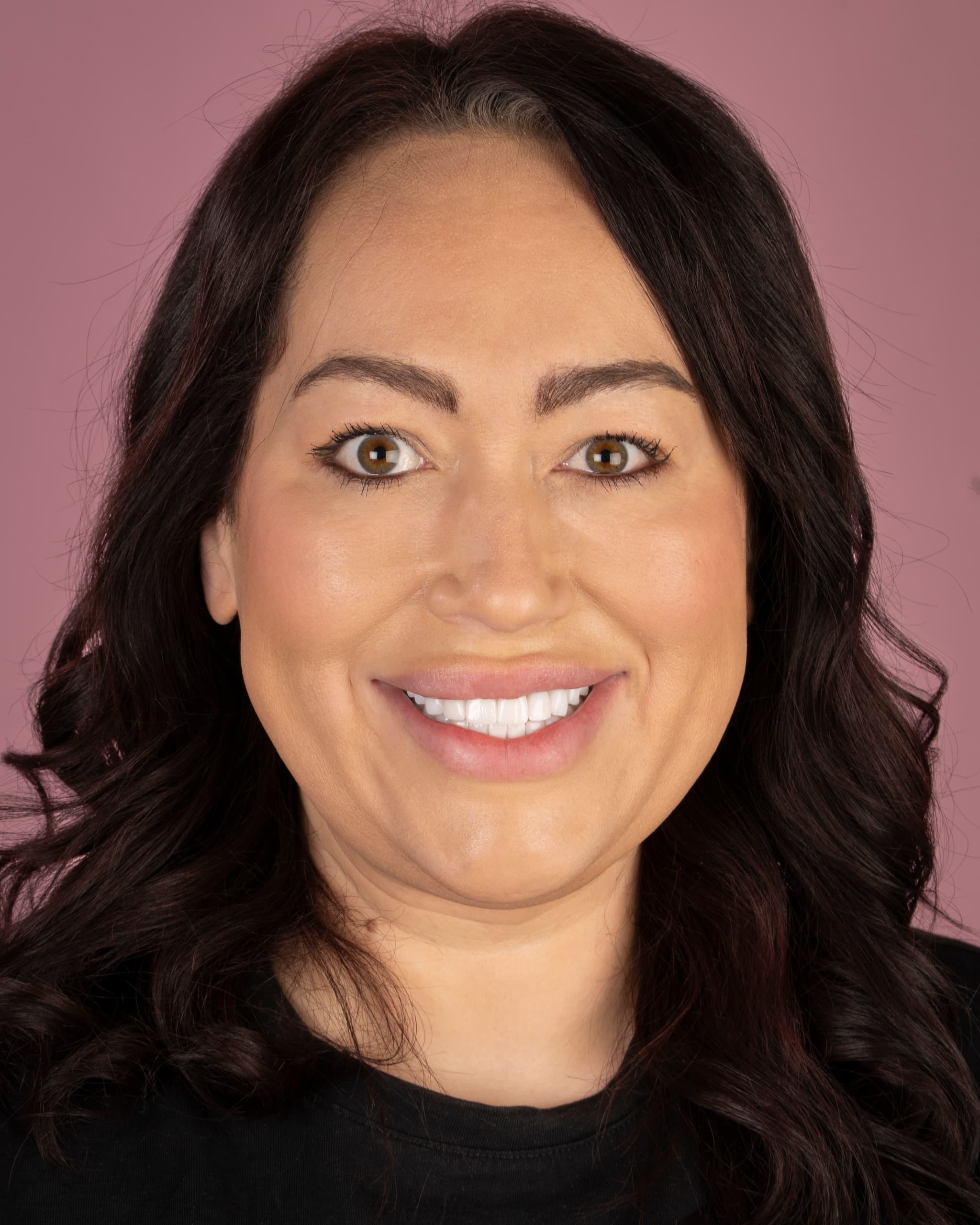 UK - Smile Design, 24x Zirconia Crowns