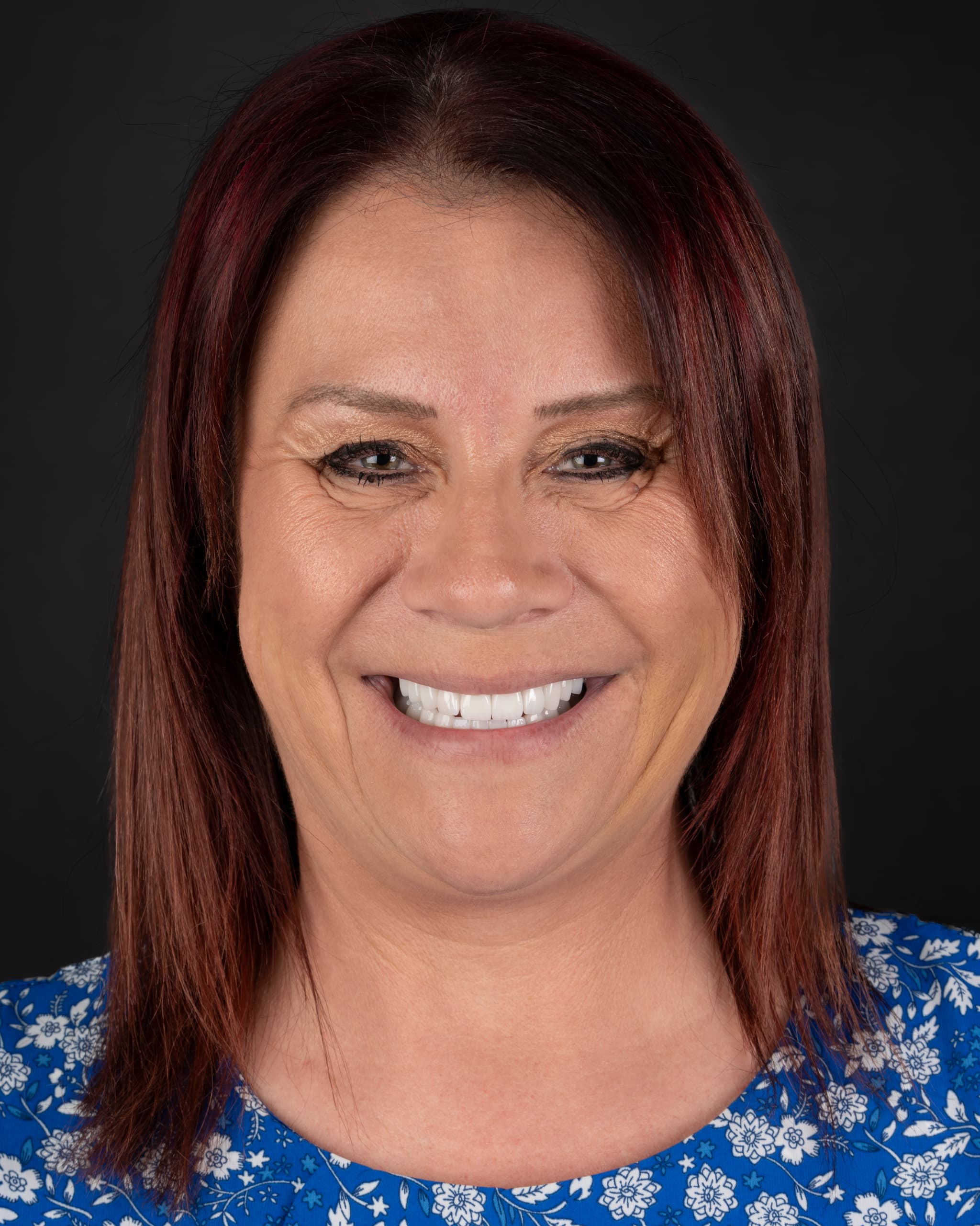 UK - Smile Design, 23x Zirconia Crowns