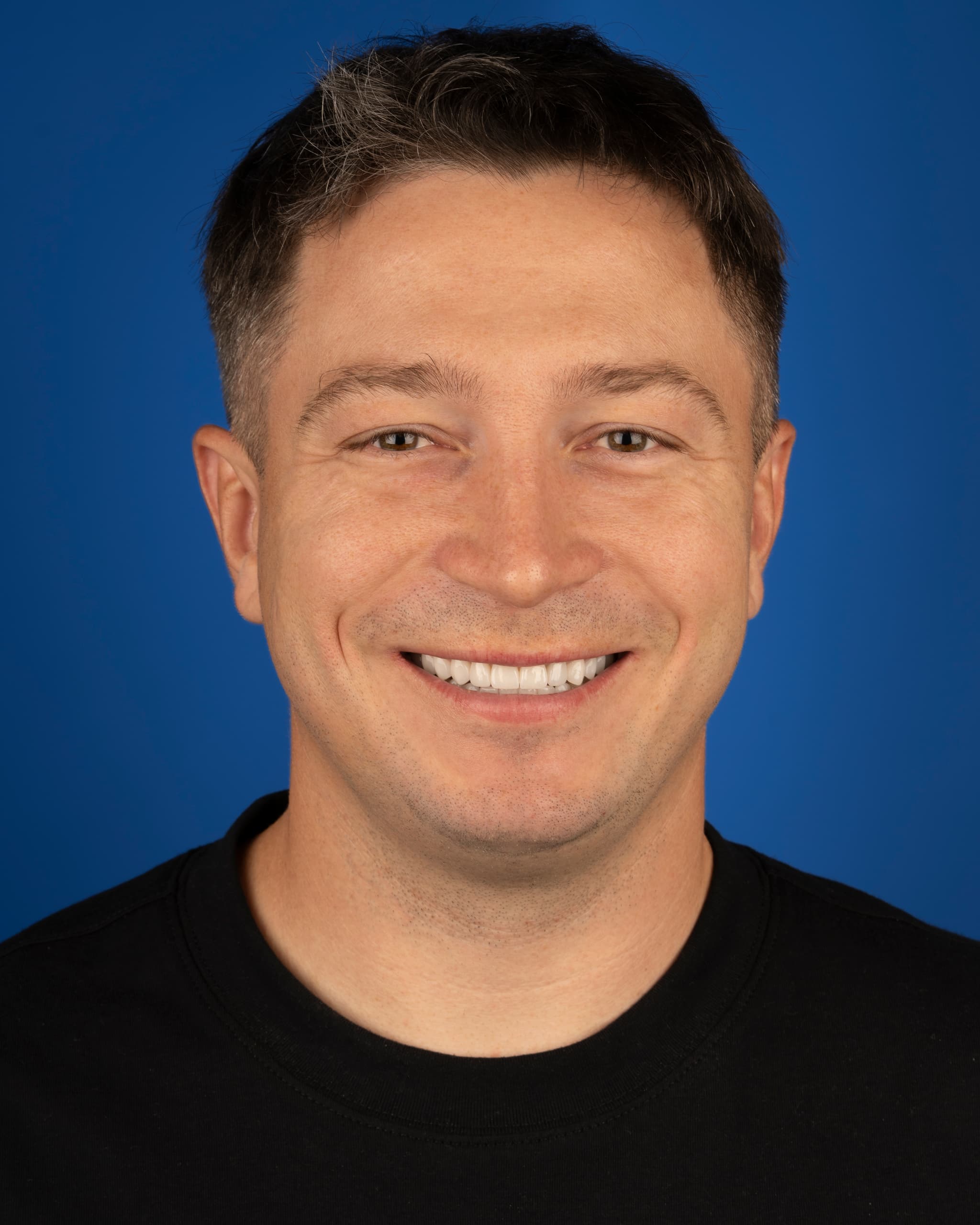 Poland - Smile Design, 28x Zirconia Crowns