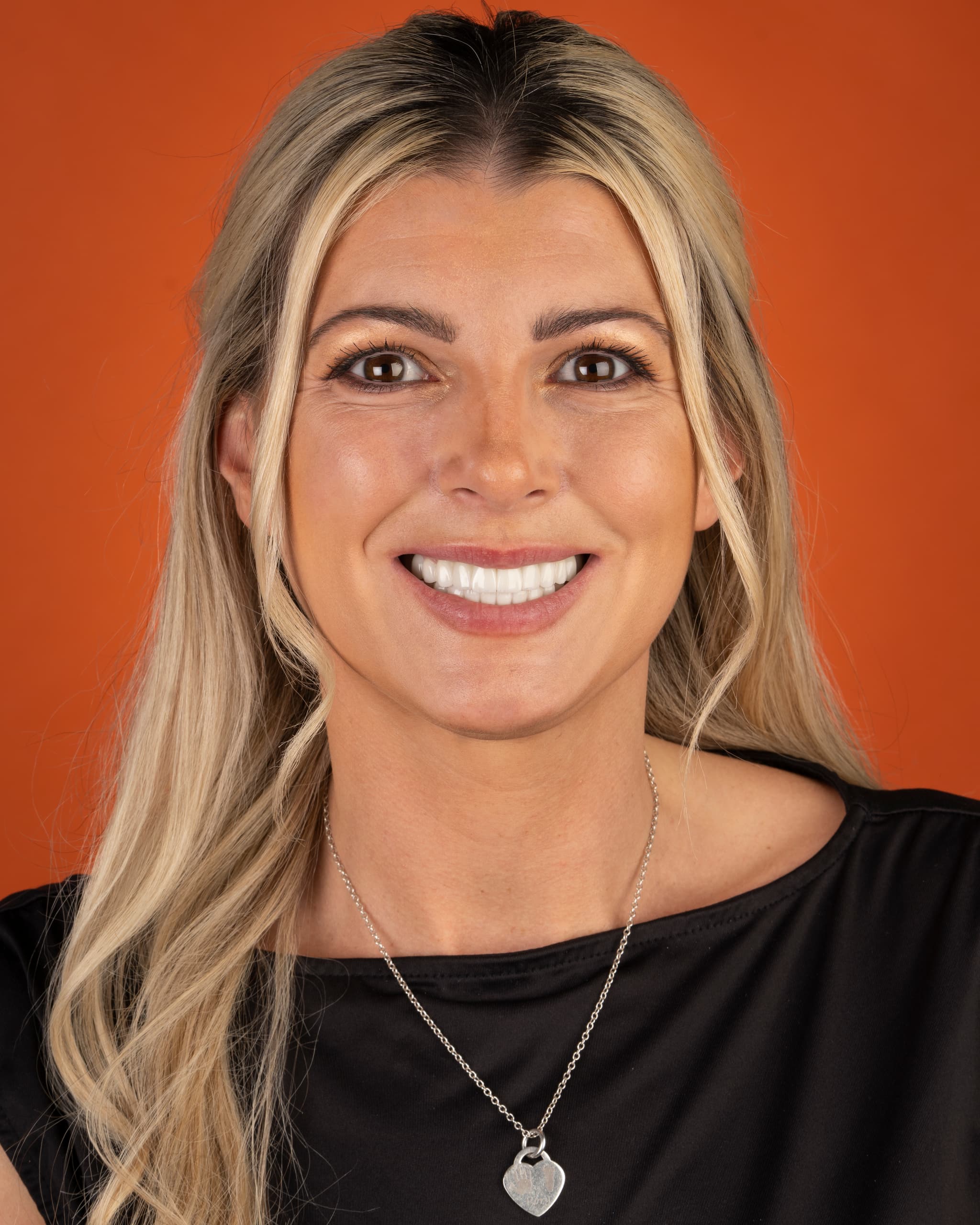 UK - Smile Design, 24x Zirconia Crowns