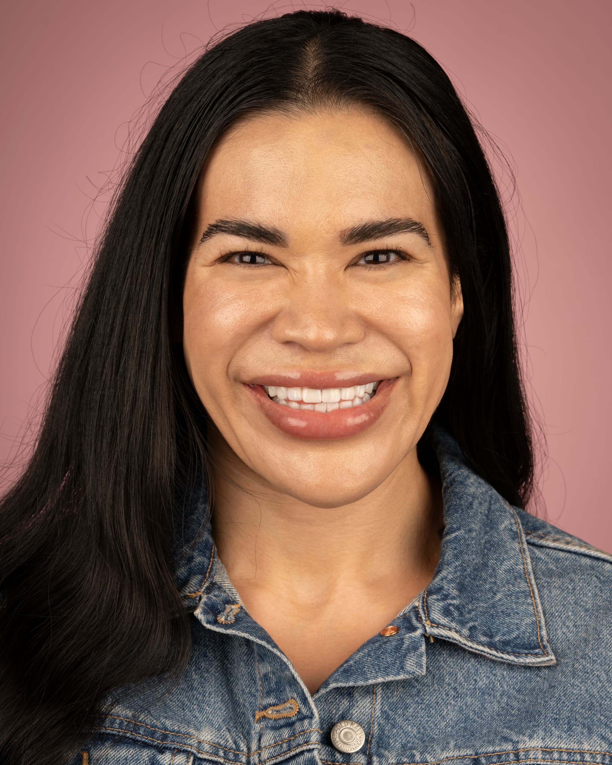 UK - Smile Design, 26x Zirconia Crowns