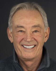 all on four dental implant