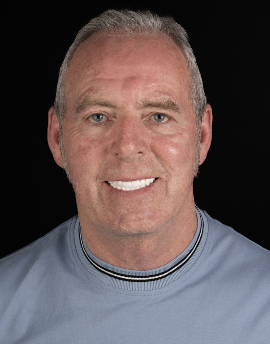 BL2 All on Four & All on X